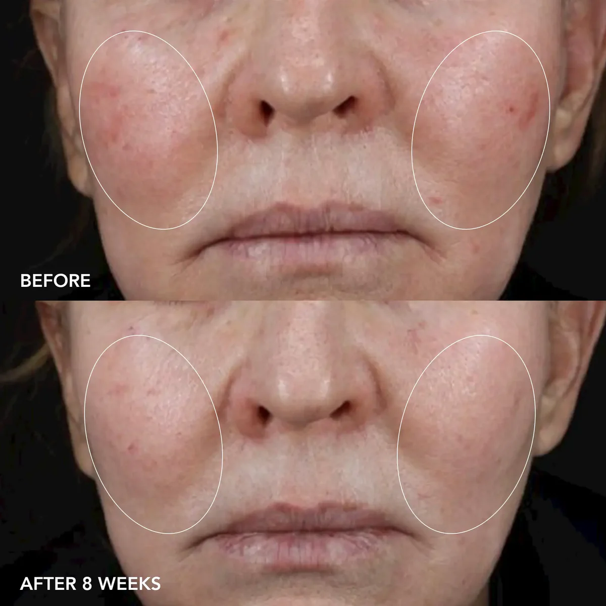 IMAGE MD Biotech Longevity Creme - Bild 4